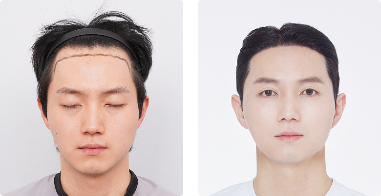 리얼포토후기 정면