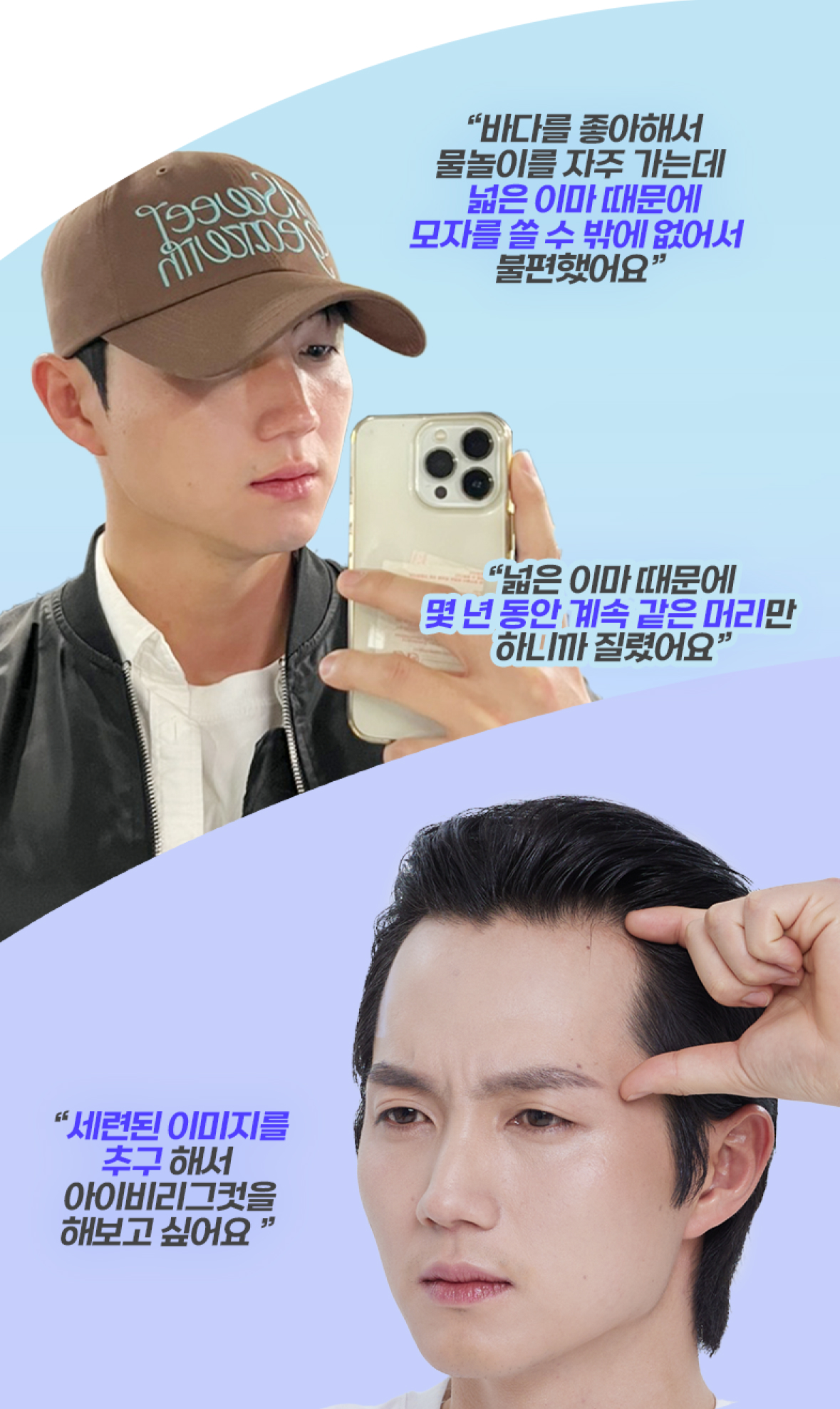 모발이식 필요성