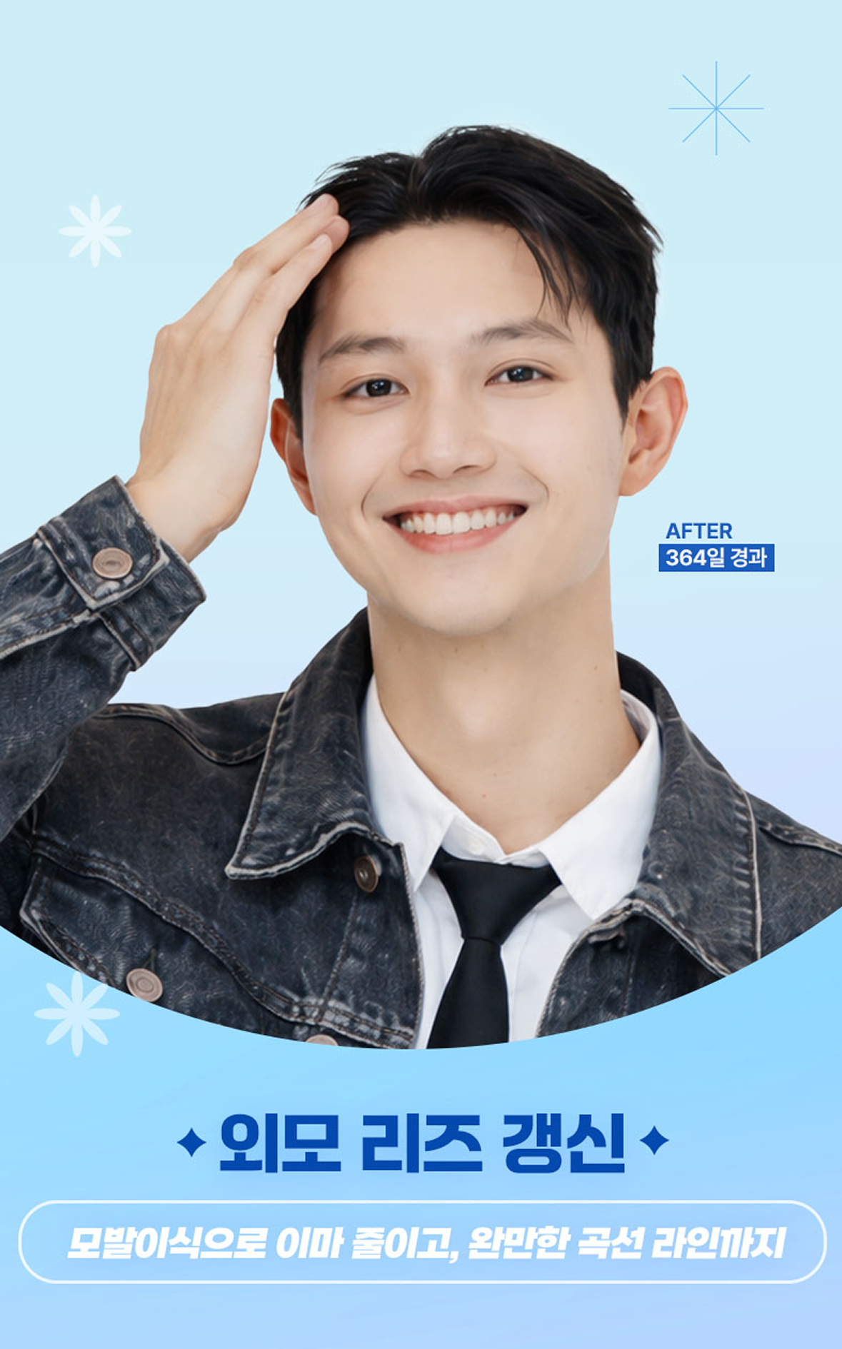 모발이식으로 이마 줄이고, 완만한 곡선 라인까지 외모 리즈 갱신